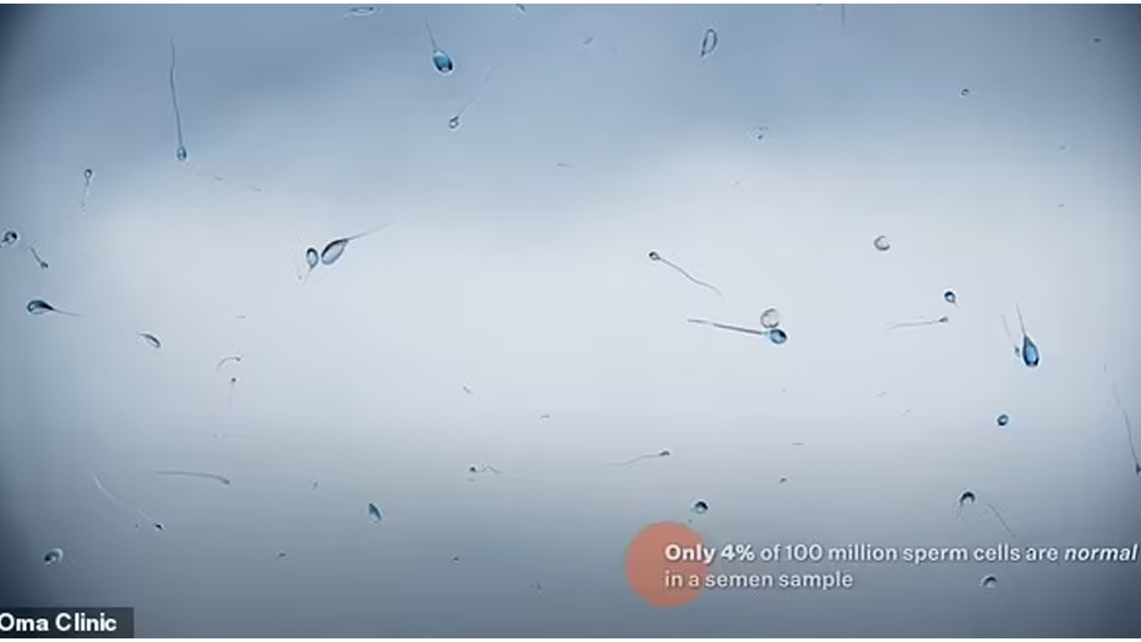 Yapay zekaya yeni bir görev daha: Sperm kalitesini ölçmek…