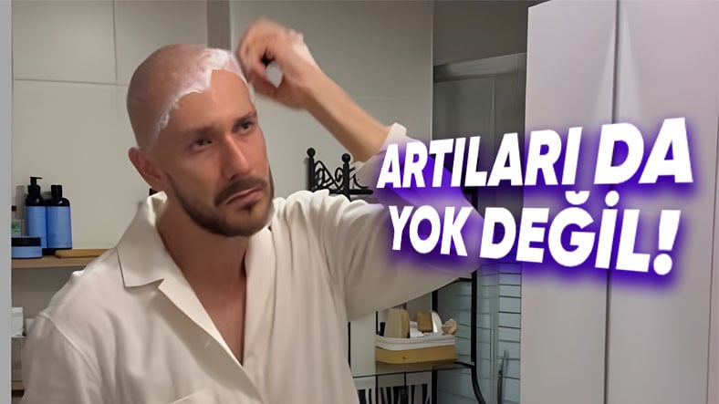 Şimdiye Kadar Neredeyse Hiç Kel Kadın Görmemenizin Asıl Sebebi Ne? İşte İçimizdeki O Kilit Faktör…