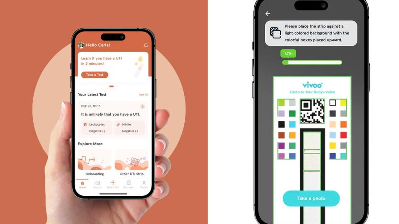 Artık evde idrar testi yapmak mümkün!